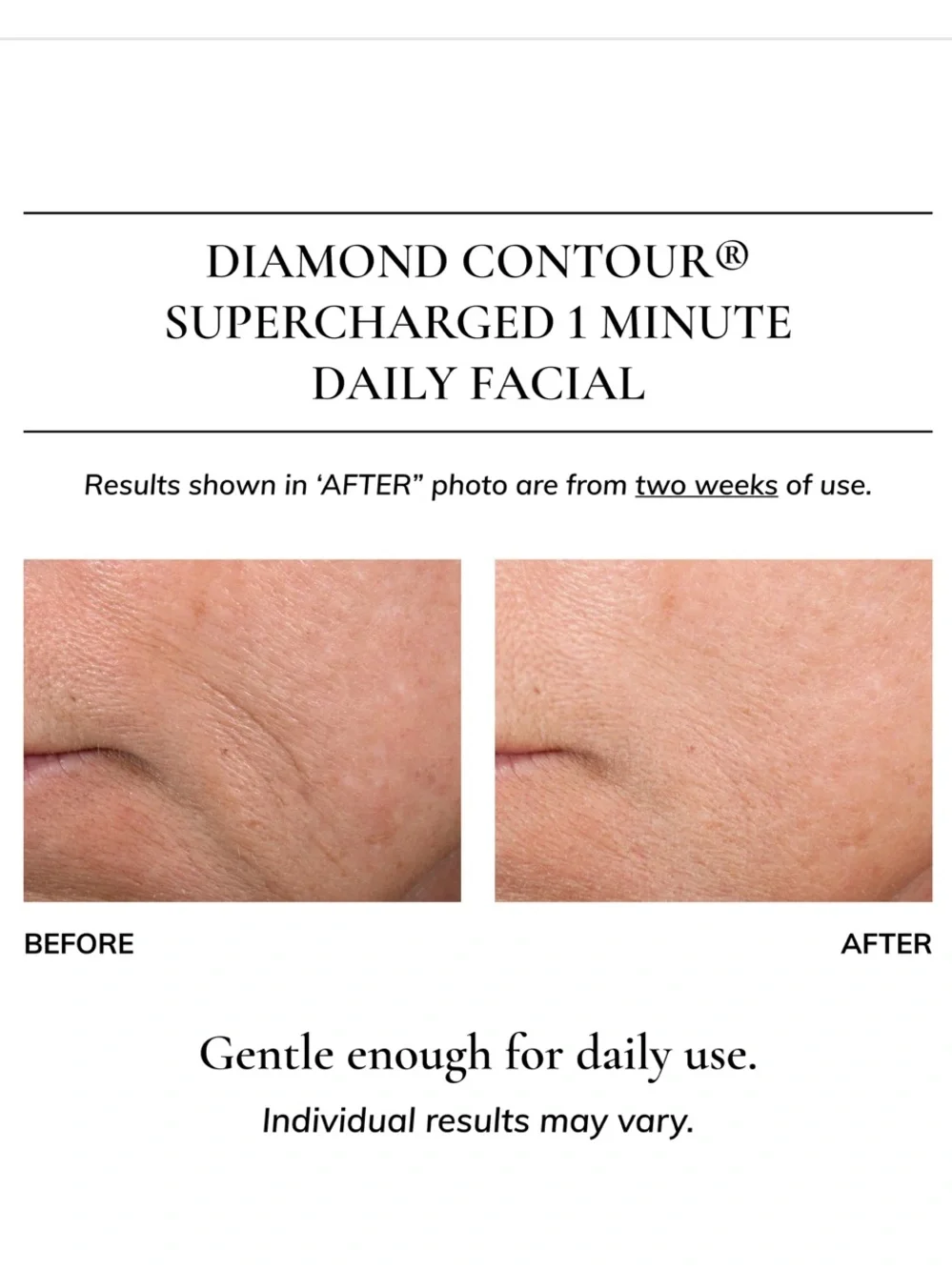 Kaplan MD Diamond Contour Supercharged 1 Minute Daily Facial 3oz/90ml